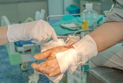 Average Cost of Burn Injury Cases Explained