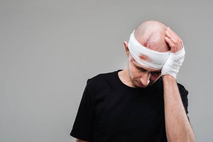 Brain Injury Settlement Guide