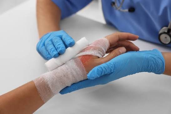 Burn Injury