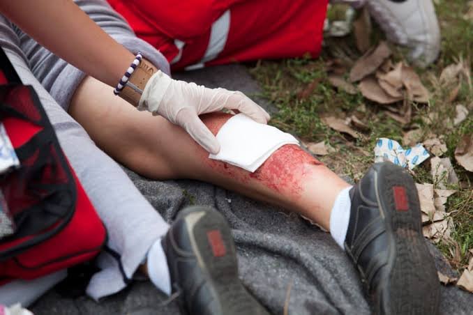 How Does Catastrophic Injury Work