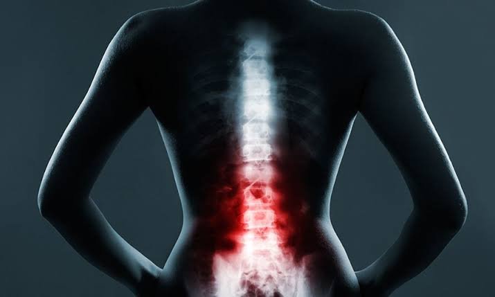 Spinal Cord Injury Settlement Guide