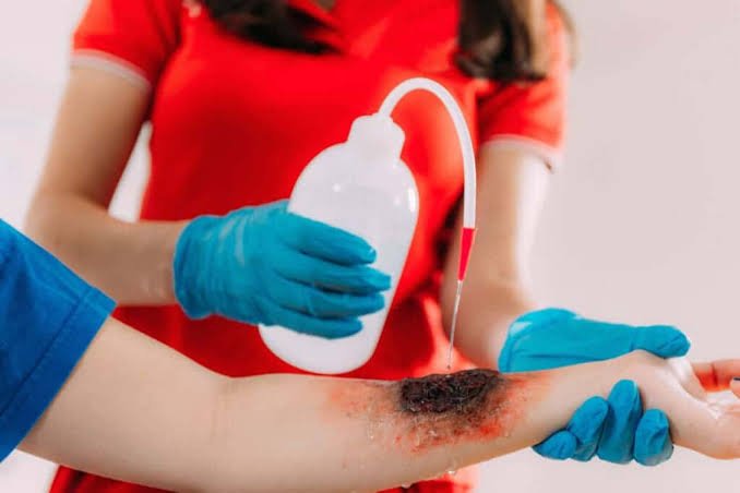 State Laws Affecting Burn Injury in the US